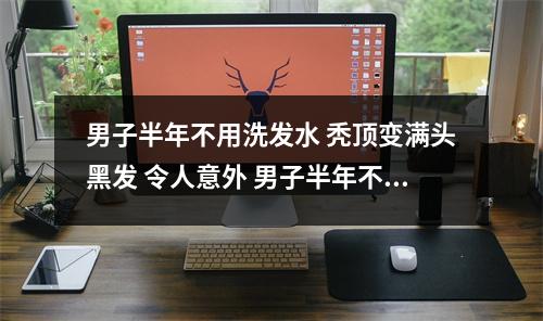 男子半年不用洗发水 秃顶变满头黑发 令人意外 男子半年不用洗发水 秃顶变满头黑～发