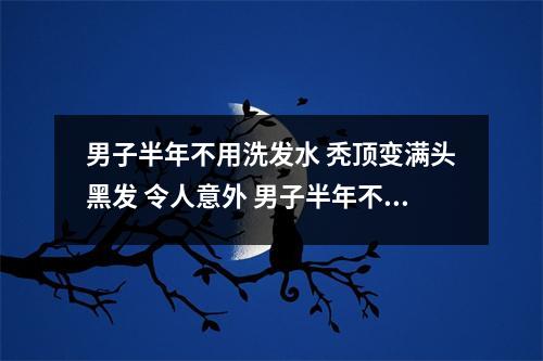 男子半年不用洗发水 秃顶变满头黑发 令人意外 男子半年不用洗发水 秃顶变满头黑发 知乎