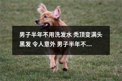 男子半年不用洗发水 秃顶变满头黑发 令人意外 男子半年不用洗发水 秃顶变满头黑发怎么办