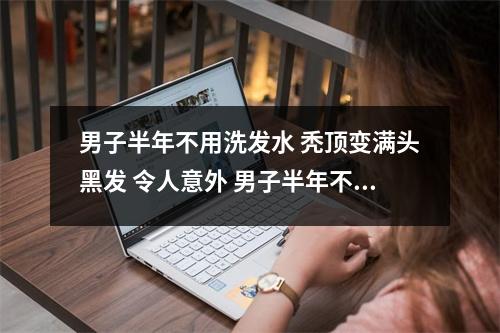 男子半年不用洗发水 秃顶变满头黑发 令人意外 男子半年不用洗发水 秃顶变满.com头黑发