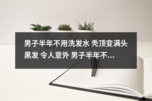 男子半年不用洗发水 秃顶变满头黑发 令人意外 男子半年不用洗发水 秃顶变满头黑发8 男子半年不用洗发水 秃顶变满头黑发 令人意外 男子半年不用洗发水 秃顶变满头黑发8