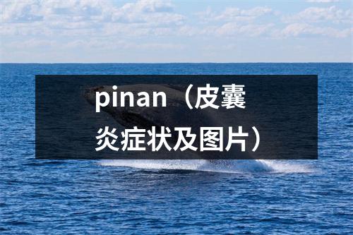 pinan（皮囊炎症状及图片）