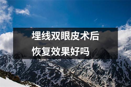 埋线双眼皮术后恢复效果好吗
