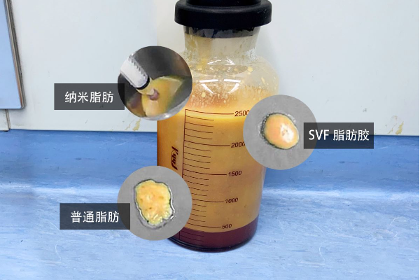 脂肪有什么元素