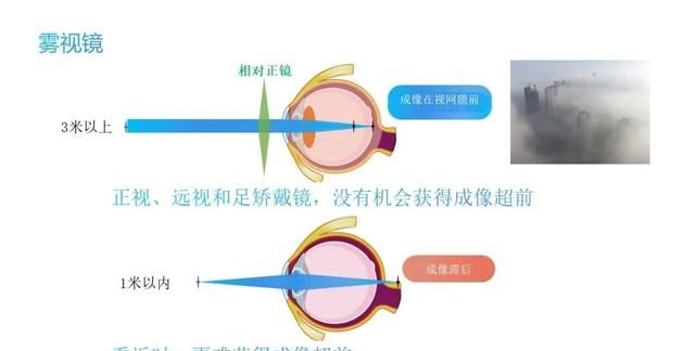雾视疗法怎么配镜,雾视镜的雾视量怎么算图7