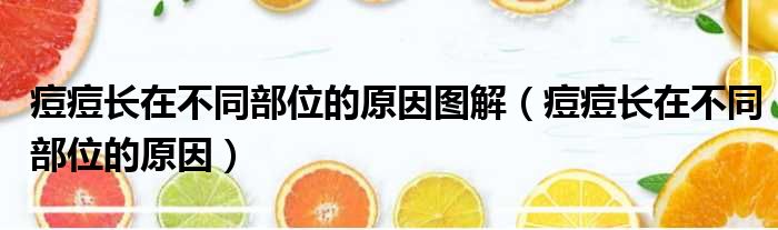 痘痘长在不同部位的原因图解 痘痘长在不同部位的原因