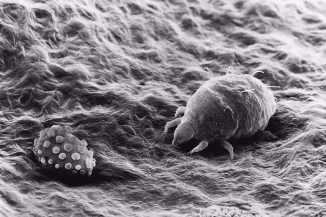 被子晒完之后有焦味是不是螨虫(暴晒的被子是螨虫烤焦的味道吗)图5