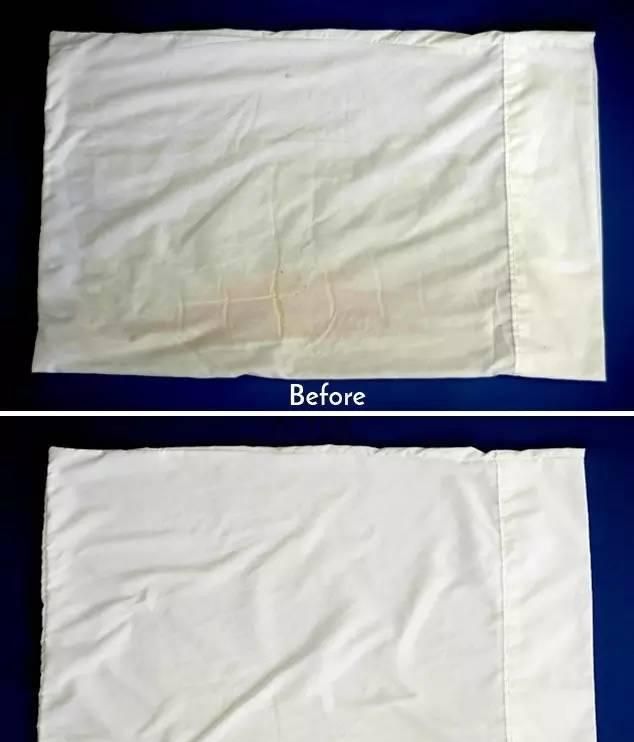 医生教你白色衣服发黄变白小妙招图3