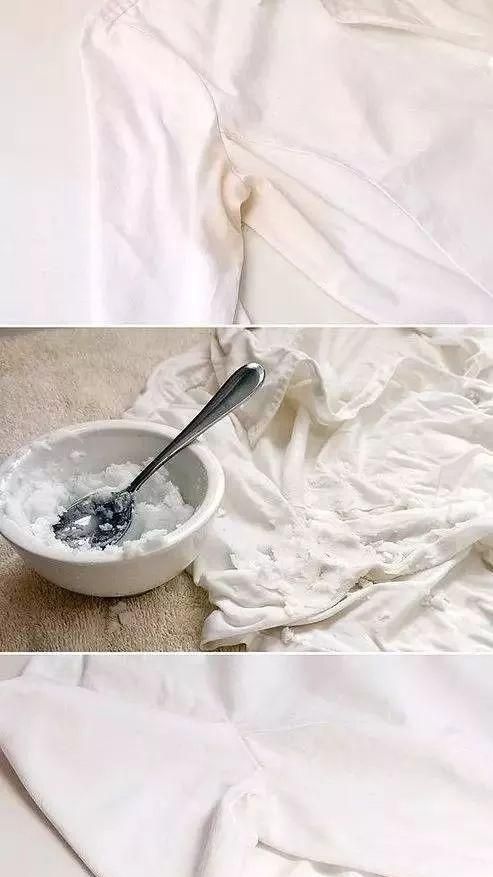 医生教你白色衣服发黄变白小妙招图4