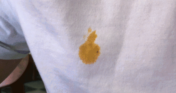 医生教你白色衣服发黄变白小妙招图5