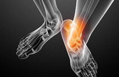 它虽然长得不出众，却能治痛风！经常拿它泡水喝，尿酸轻松降下来图3