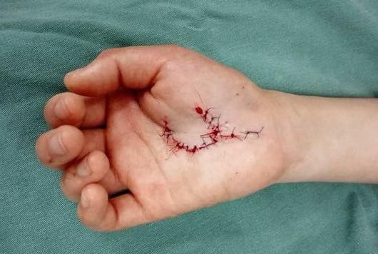 拖把与拖把杆连接处脱落 老拖把头与拖把连接处断了