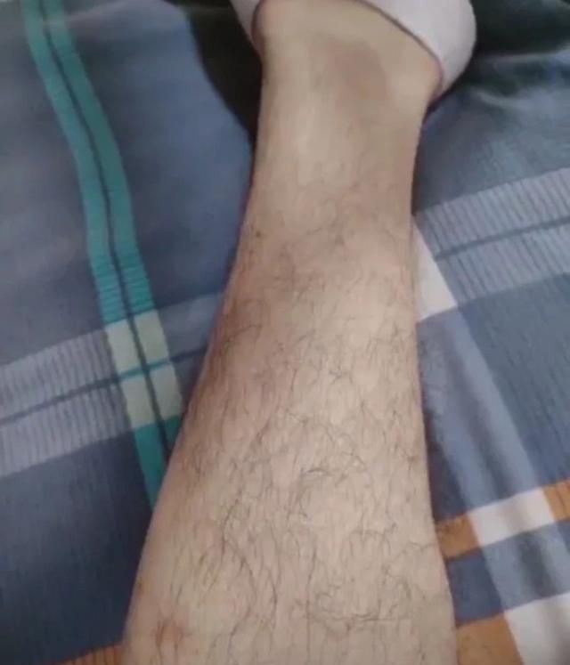 人的毛发真的会越刮越长吗 这是为什么呢