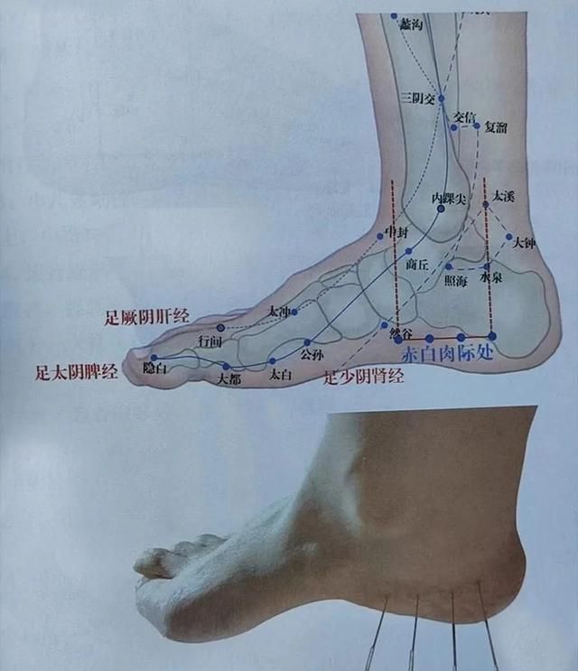 内四外三针法治什么病,帕金森特效疗法图1