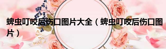 蜱虫叮咬后伤口图片大全 蜱虫叮咬后伤口图片